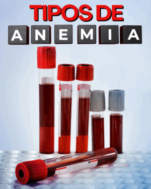 ANEMIA E SEUS TIPOS: GUIA NUTRICIONAL